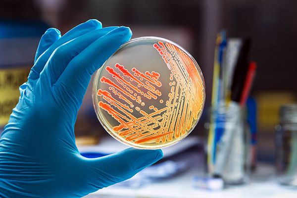 Activités microbiennes et bioprocédés – MAB